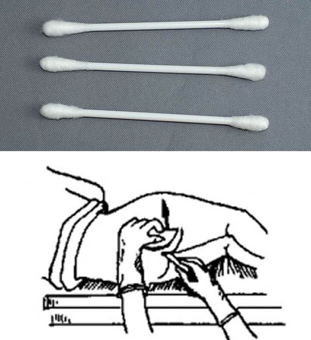 Bâtons d'analyse