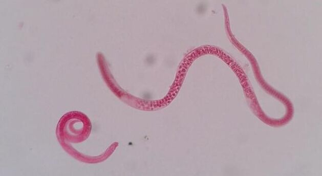 à quoi ressemblent les trichinelles 