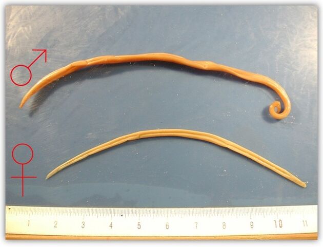 à quoi ressemblent les vers ronds